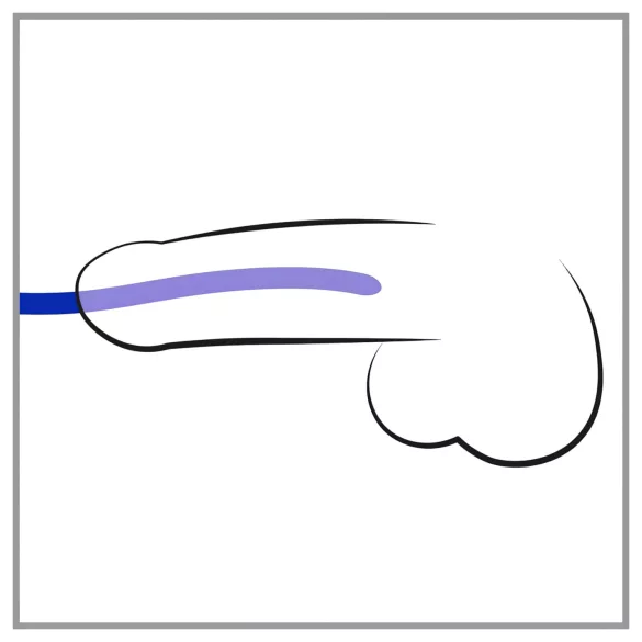 You2Toys - dilatorset - silikon - 3 delar